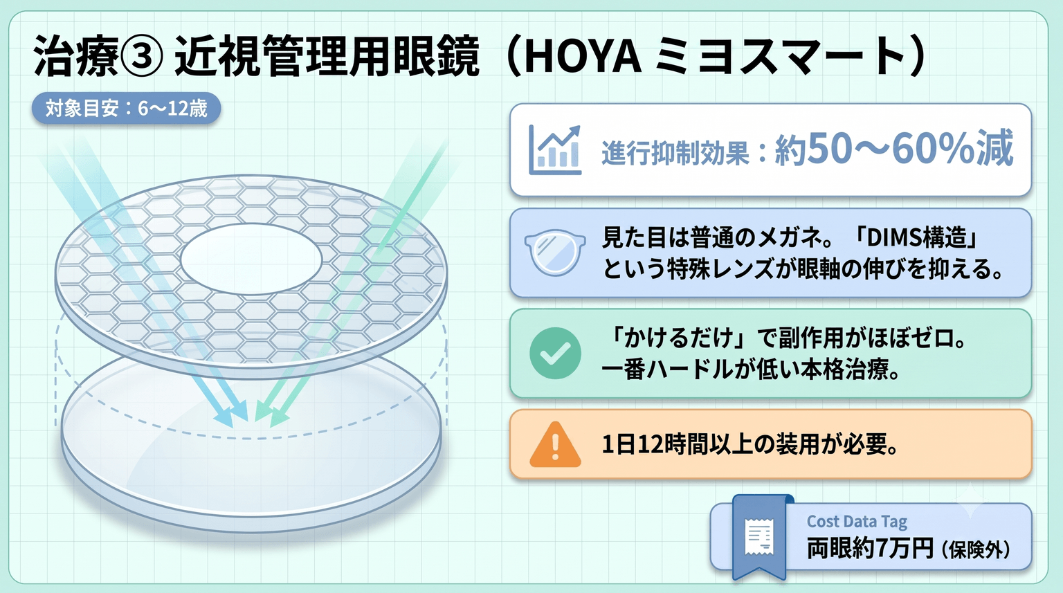 近視管理用眼鏡（HOYA ミヨスマート）の構造図。中央のクリアゾーンでくっきり見え、その周囲をハニカム状に並んだ多数の小さなセグメントが取り囲み、網膜の手前にピントを結ぶ光（近視性デフォーカス）をつくることで眼軸の伸びを抑える。対象は6〜12歳が目安、進行抑制効果は約50〜60％減、両眼で約7万円（保険外）。